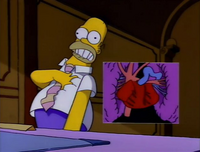 Homer's Triple Bypass.png