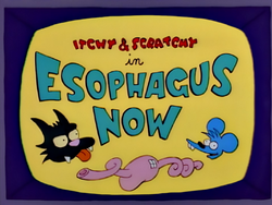 Esophagus Now.png