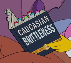 Caucasian Brittleness.png